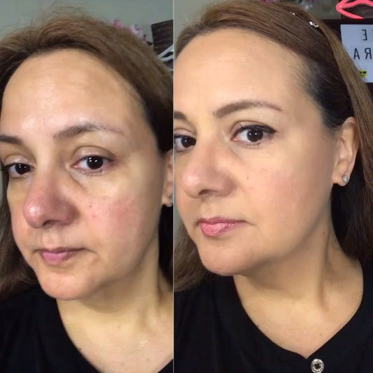 Masajeador facial - Rejuvenece Tu Rostro Desde Casa con Tecnología LED
